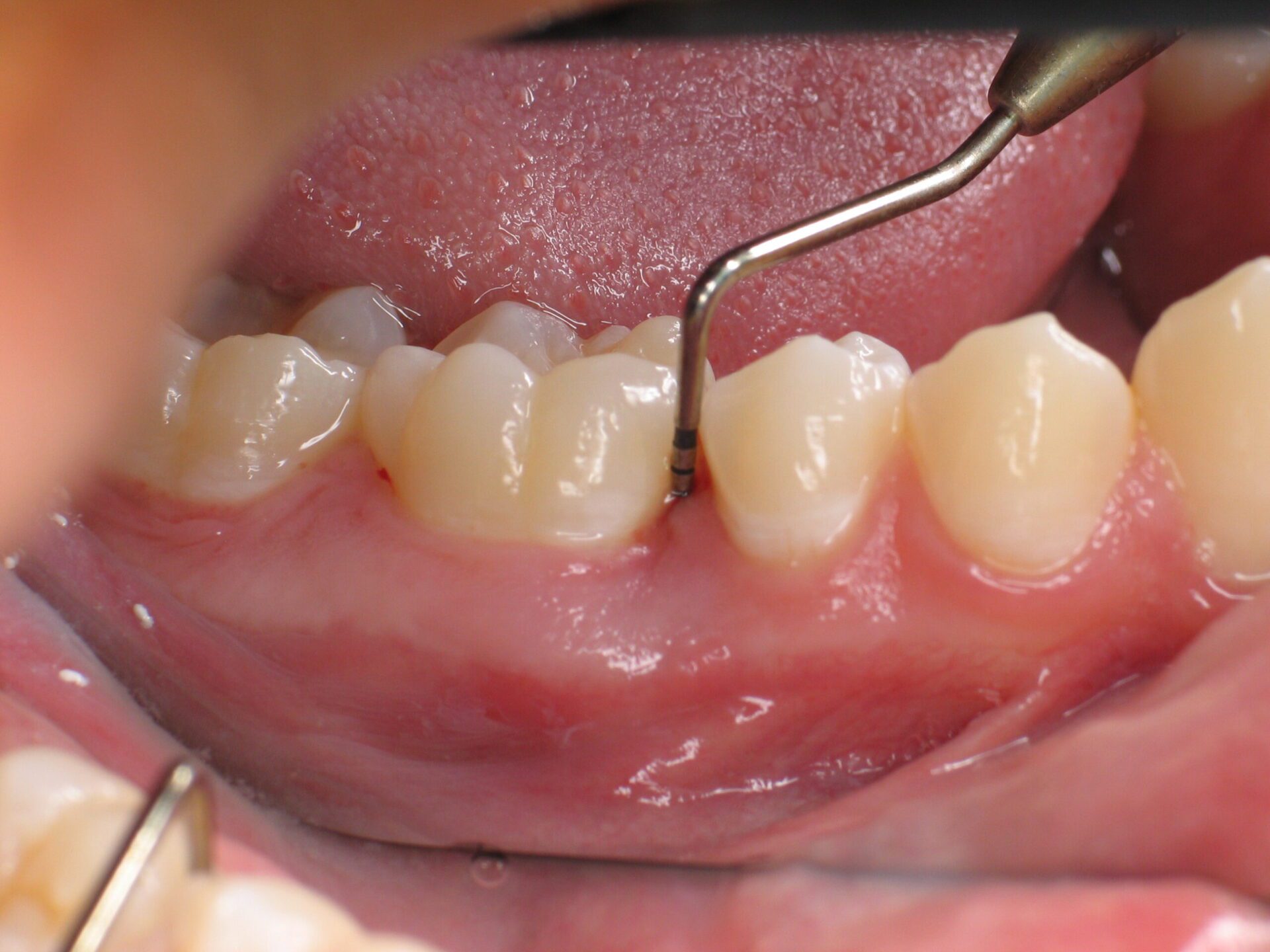 Peio exam Lifetime Dental